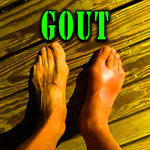 Gout