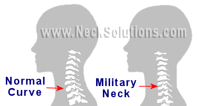 healthy neck posture